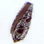 conus aulicus