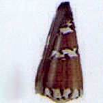 conus generalis