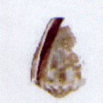 conus miliaris