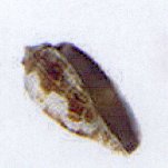 conus tulipa